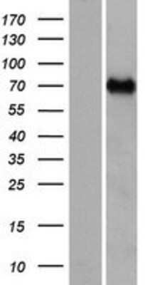 Western Blot: CCDC37 Overexpression Lysate [NBP2-04822]