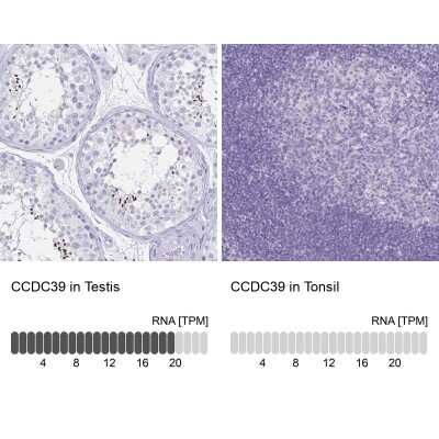 Immunohistochemistry-Paraffin: CCDC39 Antibody [NBP1-90560]