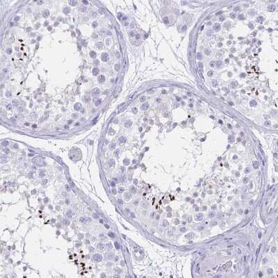 Immunohistochemistry-Paraffin: CCDC39 Antibody [NBP1-90560]