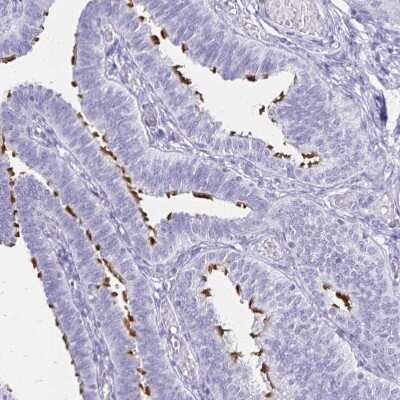 Immunohistochemistry-Paraffin: CCDC39 Antibody [NBP1-90560]