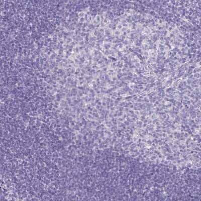 Immunohistochemistry-Paraffin: CCDC39 Antibody [NBP1-90560]
