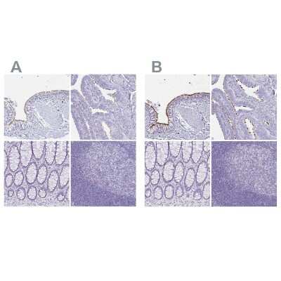 Immunohistochemistry-Paraffin: CCDC39 Antibody [NBP2-33999]