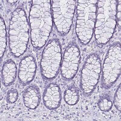 Immunohistochemistry-Paraffin: CCDC39 Antibody [NBP2-33999]