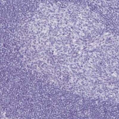 Immunohistochemistry-Paraffin: CCDC39 Antibody [NBP2-33999]