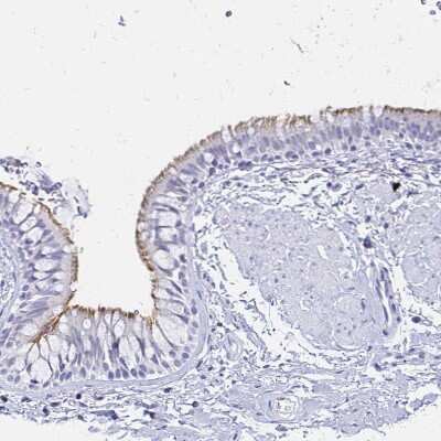 Immunohistochemistry-Paraffin: CCDC39 Antibody [NBP2-33999]