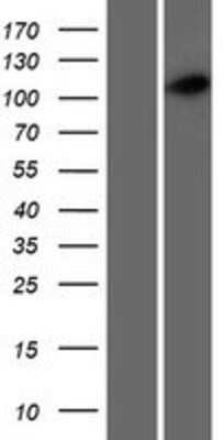 Western Blot: CCDC39 Overexpression Lysate [NBP2-10044]