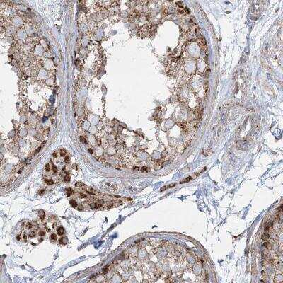 Immunohistochemistry-Paraffin: CCDC4 Antibody [NBP1-88163]