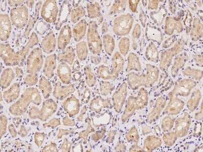 Immunohistochemistry-Paraffin: CCDC4 Antibody [NBP2-98030]