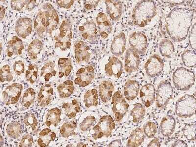 Immunohistochemistry-Paraffin: CCDC4 Antibody [NBP2-98030]