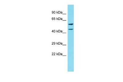 Western Blot: CCDC4 Antibody [NBP2-82588]