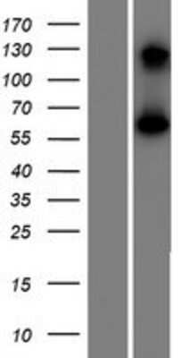 Western Blot: CCDC4 Overexpression Lysate [NBP2-04497]