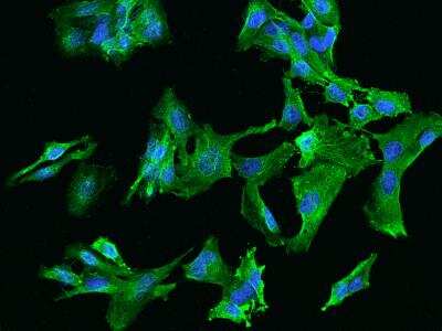 Immunocytochemistry/ Immunofluorescence: CCDC40 Antibody [NBP3-06274]