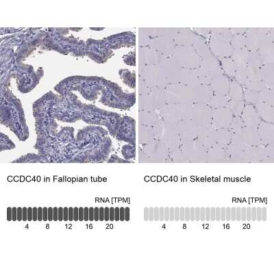 Immunohistochemistry-Paraffin: CCDC40 Antibody [NBP1-82162]