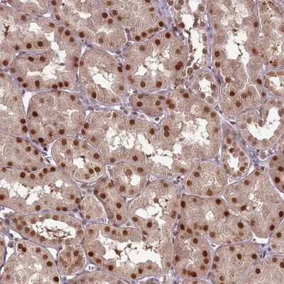 Immunohistochemistry-Paraffin: CCDC41 Antibody [NBP1-90690]