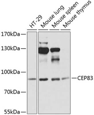 Western Blot: CCDC41 AntibodyBSA Free [NBP2-92550]