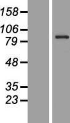 Western Blot: CCDC41 Overexpression Lysate [NBP2-07089]