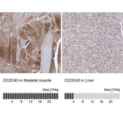 Immunohistochemistry-Paraffin: CCDC43 Antibody [NBP3-17076]