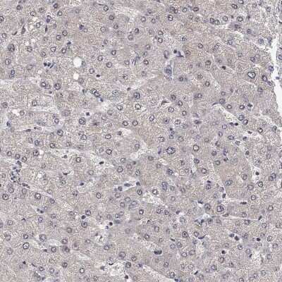 Immunohistochemistry-Paraffin: CCDC43 Antibody [NBP3-17076]