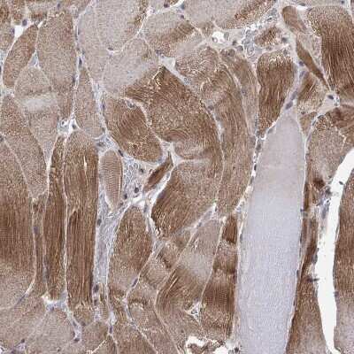 Immunohistochemistry-Paraffin: CCDC43 Antibody [NBP3-17076]