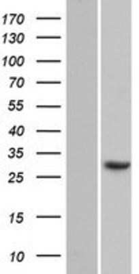 Western Blot: CCDC43 Overexpression Lysate [NBP2-05554]