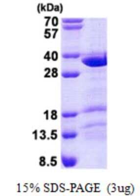 SDS-PAGE: Recombinant Human CCDC43 His Protein [NBP2-22789]