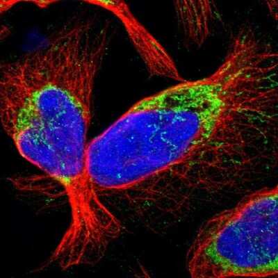 Immunocytochemistry/ Immunofluorescence: CCDC44 Antibody [NBP1-88162]