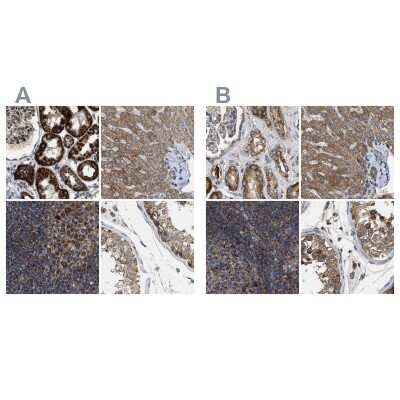 Immunohistochemistry-Paraffin: CCDC44 Antibody [NBP1-88160]