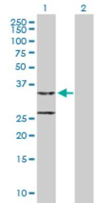 Western Blot: CCDC44 Antibody [H00051204-B01P]