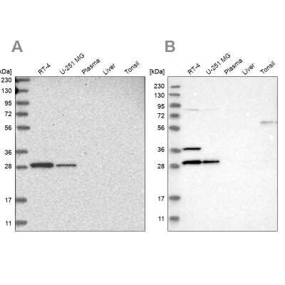 Western Blot: CCDC44 Antibody [NBP1-88161]