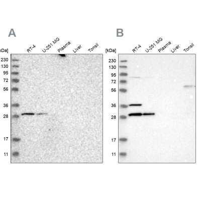 Western Blot: CCDC44 Antibody [NBP1-88162]