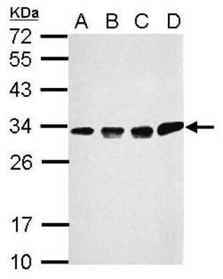 Western Blot: CCDC44 Antibody [NBP2-15749]