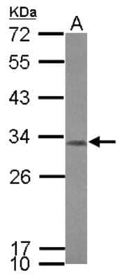 Western Blot: CCDC44 Antibody [NBP2-15750]