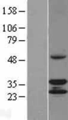 Western Blot: CCDC44 Overexpression Lysate [NBL1-08796]