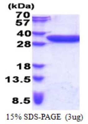 SDS-PAGE: Recombinant Human CCDC44 His Protein [NBP2-22880]