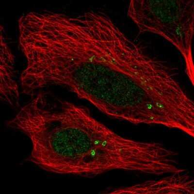 Immunocytochemistry/ Immunofluorescence: CCDC46 Antibody [NBP1-84539]