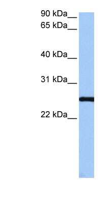 Western Blot: CCDC46 Antibody [NBP1-79545]