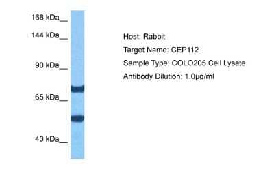 Western Blot: CCDC46 Antibody [NBP2-84612]