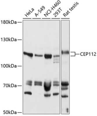 Western Blot: CCDC46 AntibodyAzide and BSA Free [NBP2-92148]