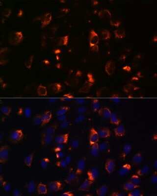 Immunocytochemistry/ Immunofluorescence: CCDC47 Antibody - Azide and BSA Free [NBP2-92269]