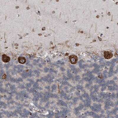Immunohistochemistry-Paraffin: CCDC47 Antibody [NBP1-93717]