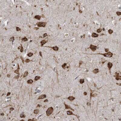 Immunohistochemistry-Paraffin: CCDC47 Antibody [NBP1-93717]