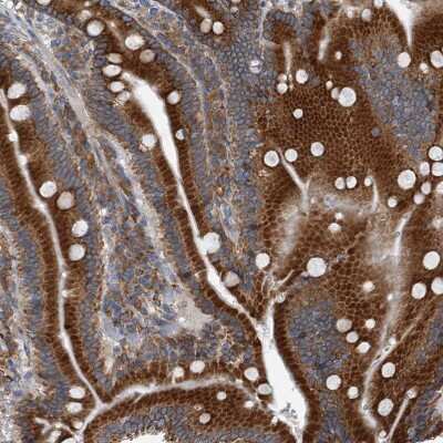 Immunohistochemistry-Paraffin: CCDC47 Antibody [NBP1-93717]
