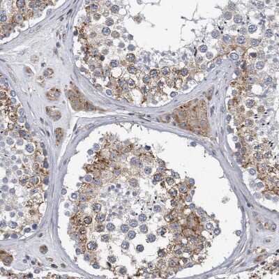 Immunohistochemistry-Paraffin: CCDC47 Antibody [NBP1-93717]