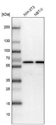 Western Blot: CCDC47 Antibody [NBP1-93717]