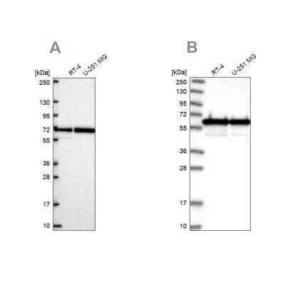 Western Blot: CCDC47 Antibody [NBP2-56445]