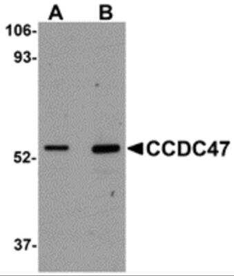 Western Blot: CCDC47 AntibodyBSA Free [NBP2-82077]