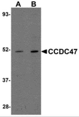 Western Blot: CCDC47 AntibodyBSA Free [NBP2-82078]