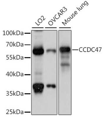 Western Blot: CCDC47 AntibodyAzide and BSA Free [NBP2-92269]