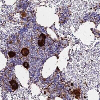 Immunohistochemistry-Paraffin: CCDC48 Antibody [NBP2-14450]