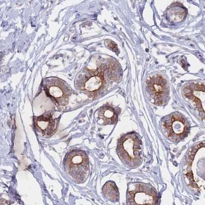 Immunohistochemistry-Paraffin: CCDC48 Antibody [NBP2-14451]